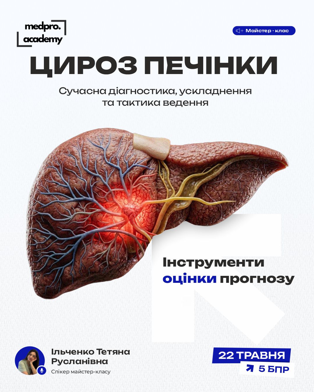 3Цироз печінки сучасна діагностика, ускладнення та тактика ведення